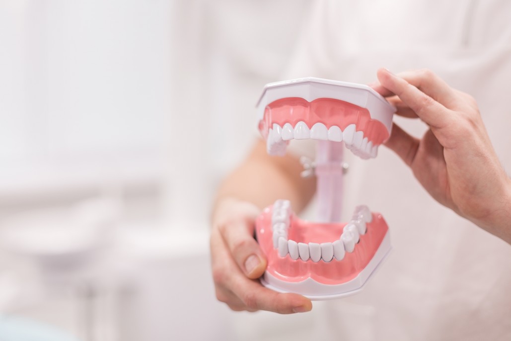 Implanty zębowe – sposób na piękny uśmiech